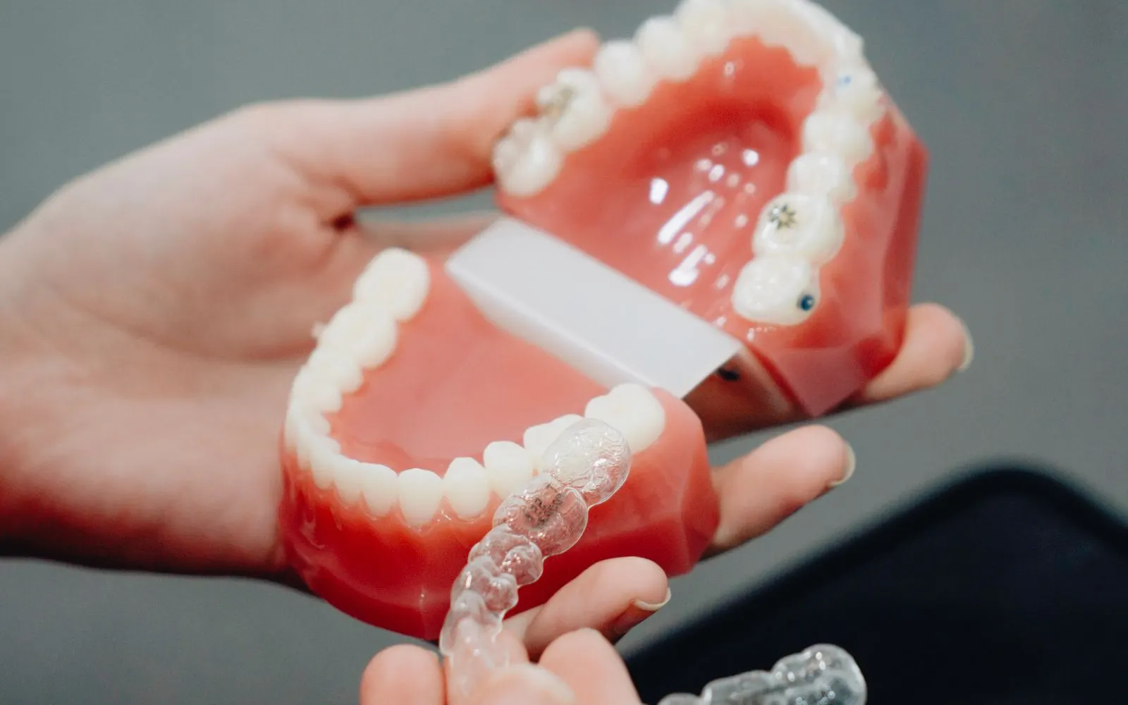 Rehabilitación completa sobre 6 implantes en Sueca